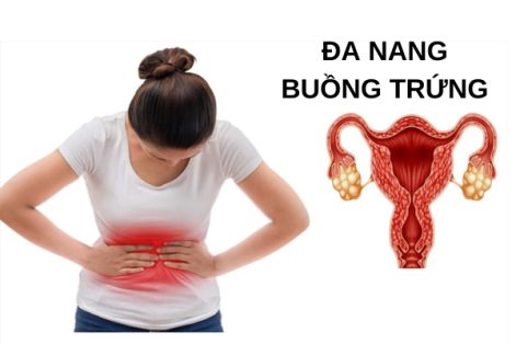 Những Tác Hại Của Đa Nang Buồng Trứng Bạn Cần Biết?