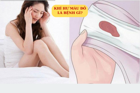 Khí Hư Màu Đỏ: Dấu Hiệu Bệnh Lý Nguy Hiểm Ở Nữ Giới