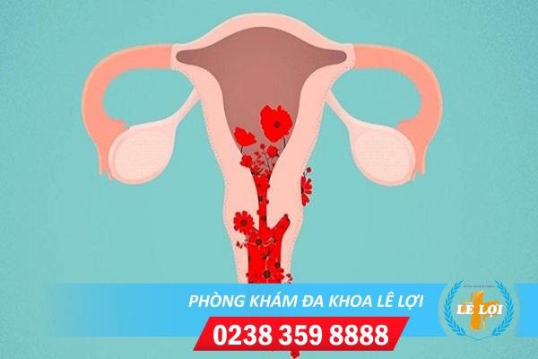 Phương Pháp Hỗ Trợ Cách Chữa Bệnh Rong Kinh Ở Nữ Giới