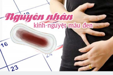 Kinh nguyệt màu đen là do đâu?