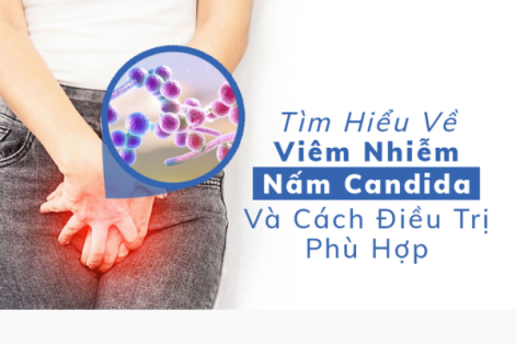 Dấu hiệu nhận biết bệnh nấm Candida