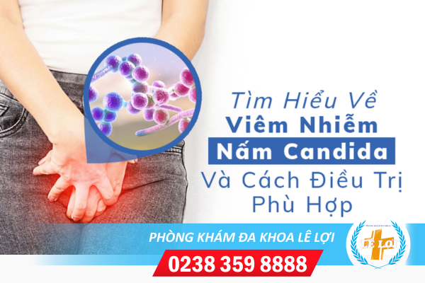 Dấu hiệu nhận biết bệnh nấm Candida