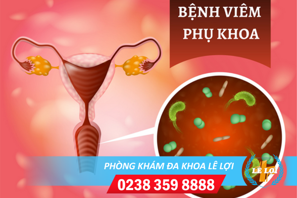 Dấu hiệu bệnh viêm nhiễm phụ khoa