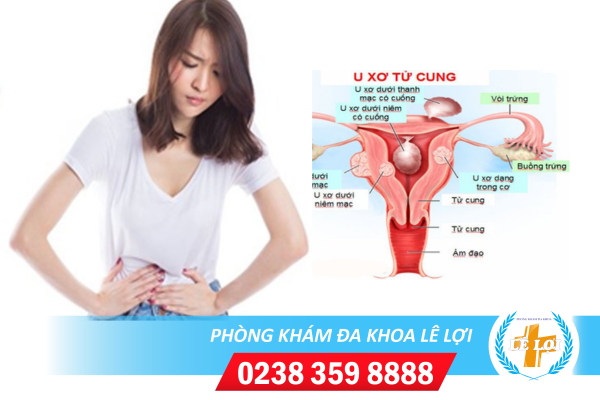 Đau bụng dưới là dấu hiệu của bệnh gì?