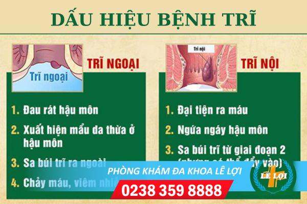 Các Triệu Chứng Bệnh Trĩ Hay Gặp Là Gì?