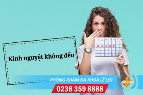 Thế nào được xem là kinh nguyệt không đều ?