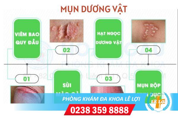Nổi mụn ở dương vật dấu hiệu nhiều bệnh nguy hiểm