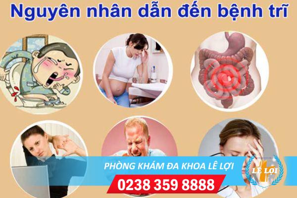 Triệu Chứng Bệnh Trĩ Ở Người Bệnh Dễ Nhận Biết