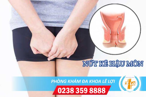 Nứt Kẽ Hậu Môn Là Gì Và Cách Hỗ Trợ Điều Trị Hiệu Quả