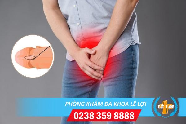 Nguyên nhân rách bao quy đầu sau khi quan hệ