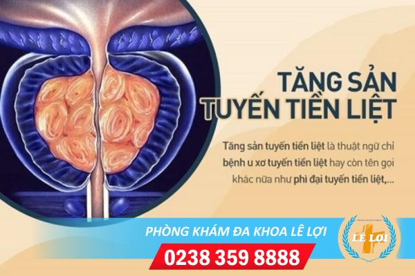 Tăng sản tuyến tiền liệt ở nam giới