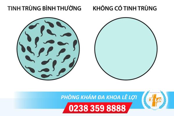 Chữa bệnh vô tinh ở đâu tốt nhất? Chi phí chữa là bao nhiêu