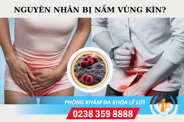 Nấm vùng kín ở nam và nữ