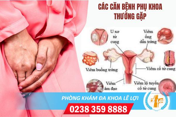 Dấu hiệu nhận biết bệnh phụ khoa