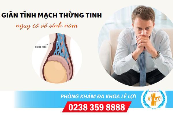 Hỗ trợ điều trị giãn mạch thừng tinh tại Đa Khoa Lê Lợi