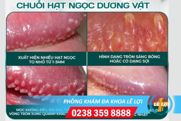 hat-ngoc-duong-vat