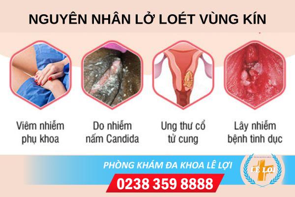 Lở loét vùng bẹn và háng là bệnh gì ?