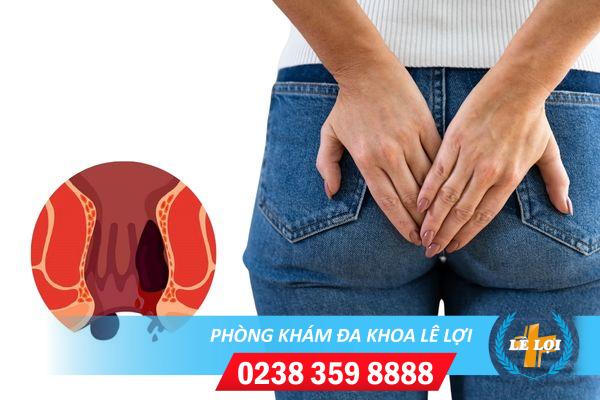 Báo động đỏ khi ra máu hậu môn