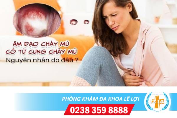 Âm đạo chảy mủ, cổ tử cung chảy mủ nguyên nhân do đâu, cách chữa thế nào?