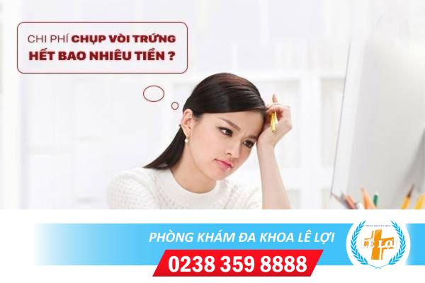 Chi phí chụp vòi trứng hết bao nhiêu tiền?