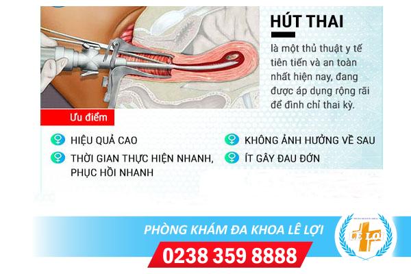 Phá thai bằng kỹ thuật hút thai chân không