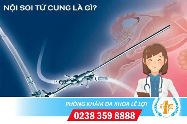 Nội soi tử cung là gì? Tại sao cần nội soi tử cung?