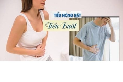 Tiểu rát, tiểu buốt là mắc bệnh gì?