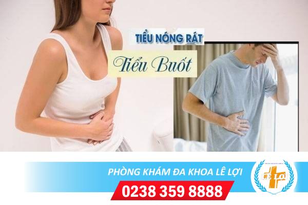 Tiểu rát, tiểu buốt là mắc bệnh gì?