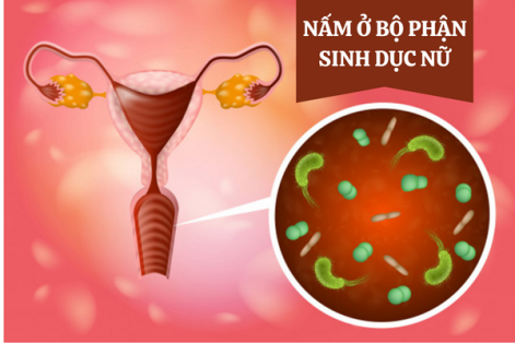 Nguyên nhân gây nấm ở bộ phận sinh dục