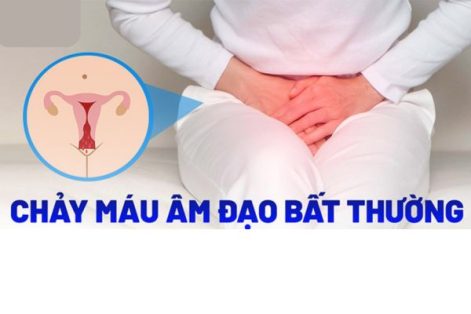 Những bệnh lý nguy hiểm gây xuất huyết âm đạo