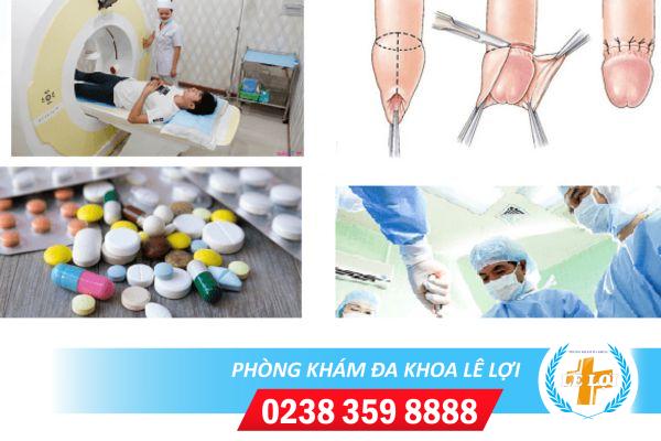 Phương Pháp Hỗ Trợ Điều Trị Viêm Bao Quy Đầu Tốt