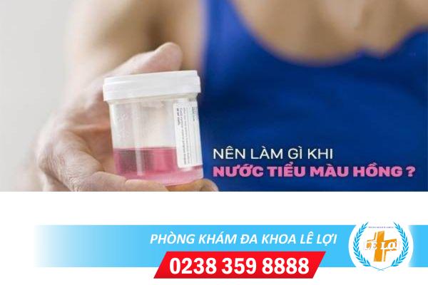 Nên làm gì khi nước tiểu màu hồng?