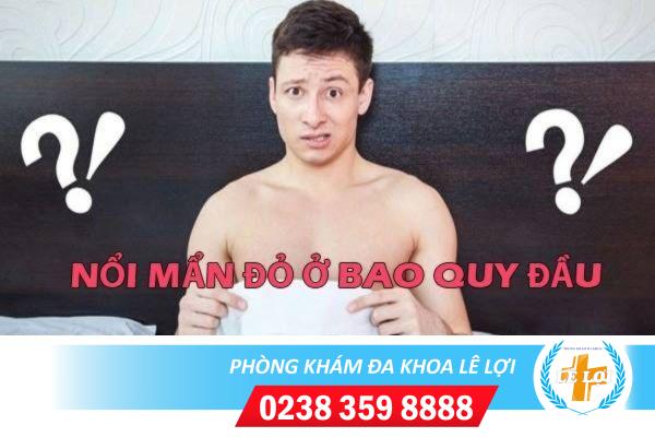 Nguyên nhân gây nổi mẩn đỏ ở bao quy đầu là gì?