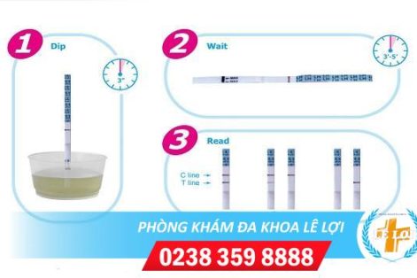 Trễ kinh bao lâu thì thử thai được?