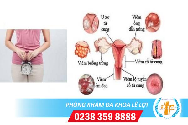 Các bệnh phụ khoa thường gặp ở nữ giới