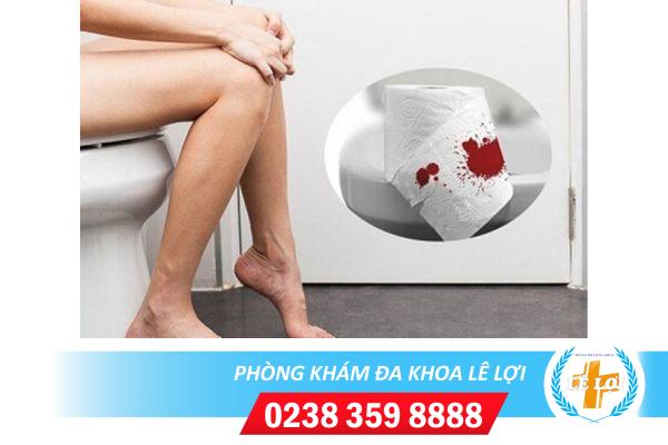 Đi cầu ra máu là dấu hiệu bệnh gì cách điều trị hiệu quả