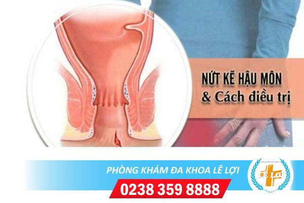 Biểu hiện của nứt kẽ hậu môn và cách điều trị hiệu quả