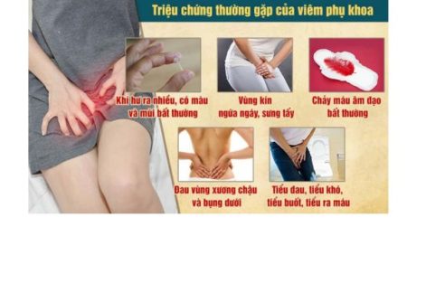 Triệu chứng của bệnh viêm nhiễm phụ khoa