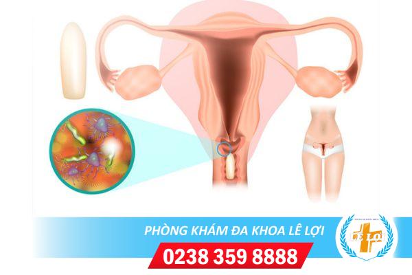 Lê Lợi – Phòng khám phụ khoa tư nhân chất lượng