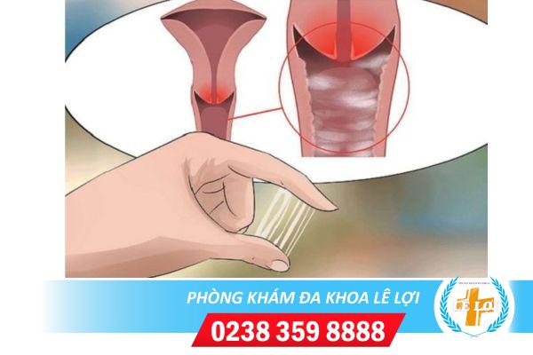 Đang bị viêm nhiễm phụ khoa có mang thai được không?