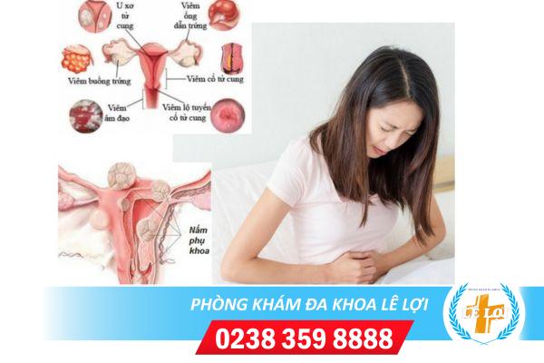 Các loại thuốc chữa bệnh phụ khoa hiệu quả nhất hiện nay