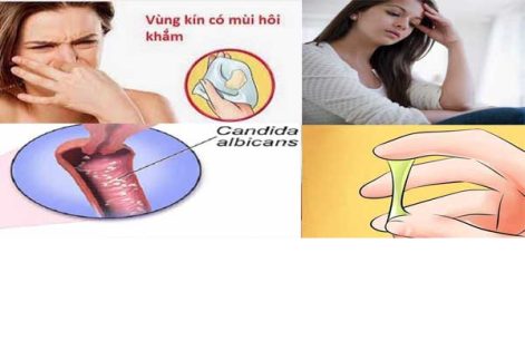 Chữa Viêm Phụ Khoa Hiệu Quả Tại Phòng Khám Phụ Khoa Lê Lợi