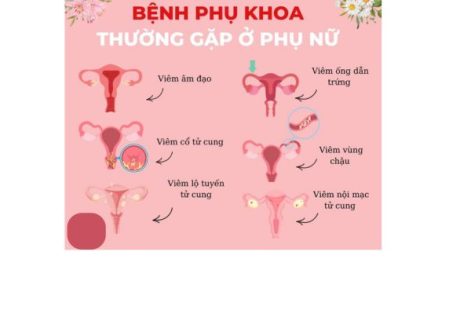 Biểu hiện viêm nhiễm phụ khoa nặng ở nữ