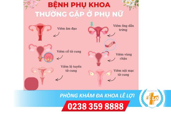 Biểu hiện viêm nhiễm phụ khoa nặng ở nữ