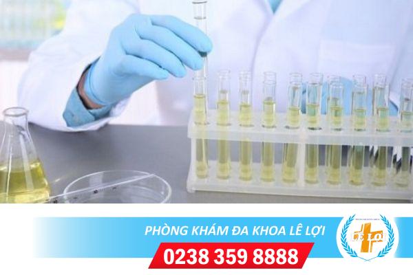 Xét Nghiệm Phụ Khoa An Toàn – Chính Xác – Bảo Mật