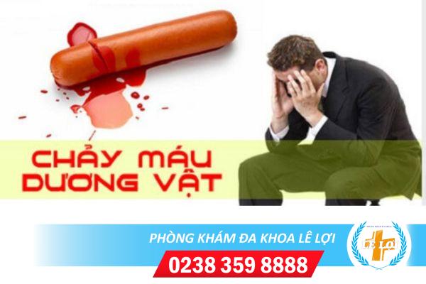 Tại sao nam giới lại bị dương vật chảy máu?