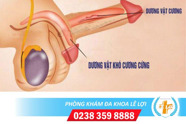 Cách hỗ trợ chữa liệt dương hiệu quả cao tại Phòng khám Lê Lợi