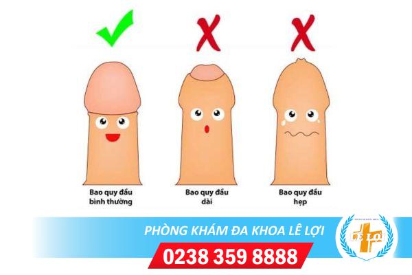 HẸP BAO QUY ĐẦU CÓ CẦN CẮT KHÔNG?