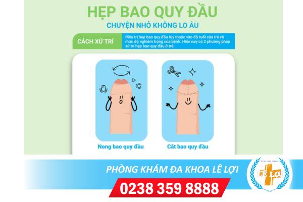 Những cách hỗ trợ chữa hẹp bao quy đầu hiệu quả cho nam giới