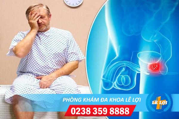 Suy tinh hoàn có gây vô sinh không ?
